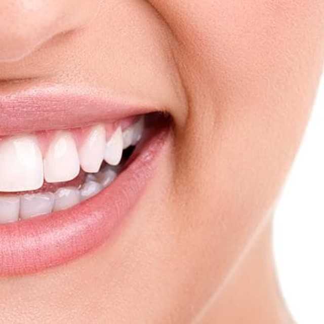 5 tipos de aparatos dentales y correctores