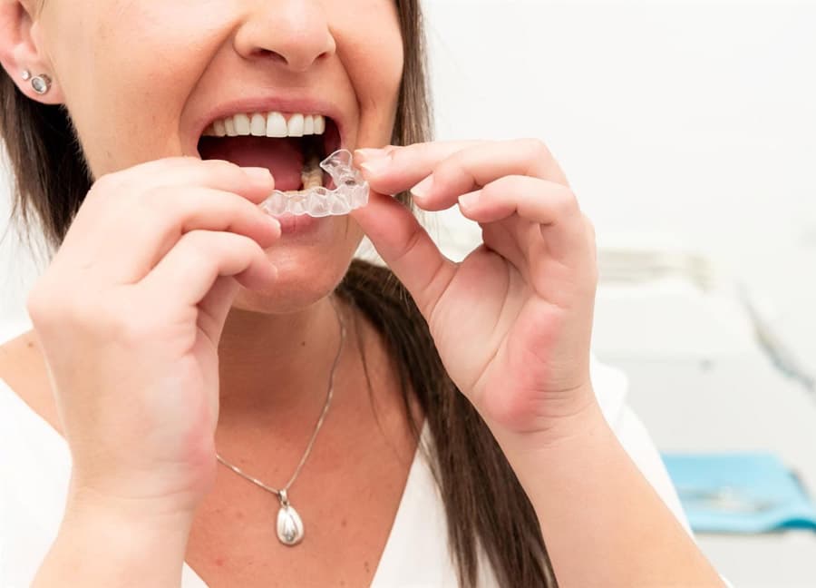 Expertos en tratamientos de ortodoncia invisible: Invisalign