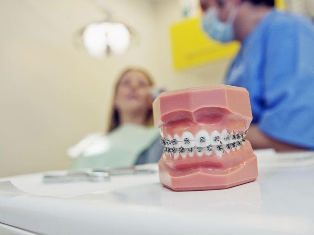 Los tipos de ortodoncias que existen