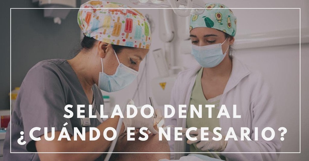 ¿Qué es un sellado dental y cuándo es necesario?