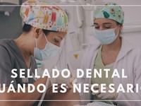 ¿Qué es un sellado dental y cuándo es necesario?