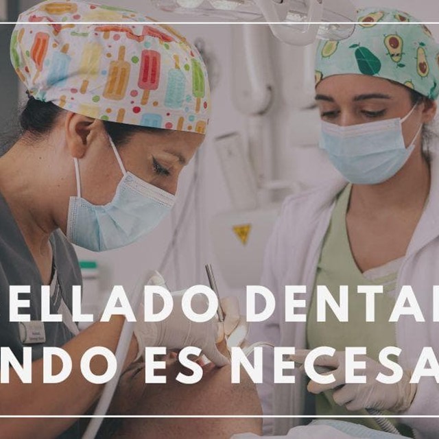 ¿Qué es un sellado dental y cuándo es necesario?