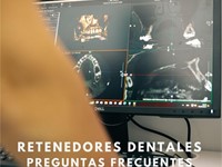 Retenedores Dentales: Preguntas más frecuentes sobre su funcionamiento y mantenimiento